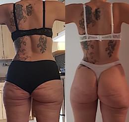 Client Before-After.