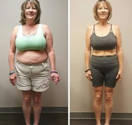 Client Before-After.