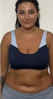 Before rootz body shape.